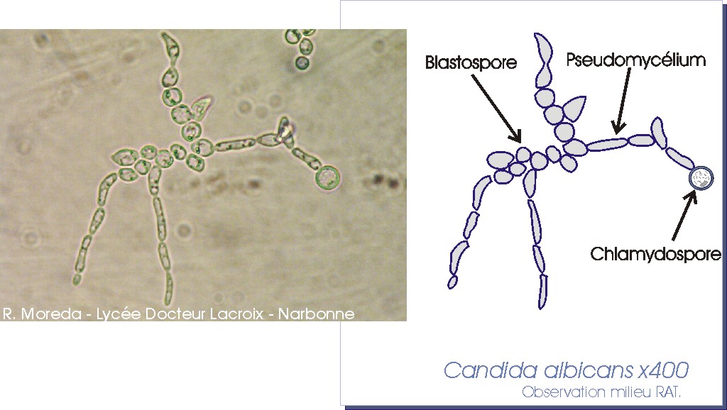 Candida albicans chlamydospore