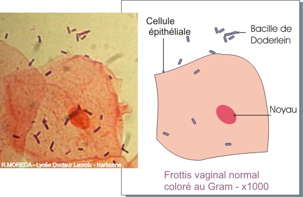 Frottis vaginal normal